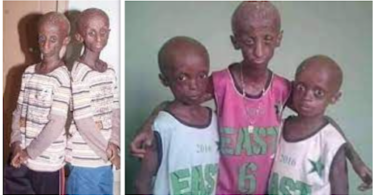 See The Children Of Late Taiwo And Kehinde Osuolale (Ibeji Oran)