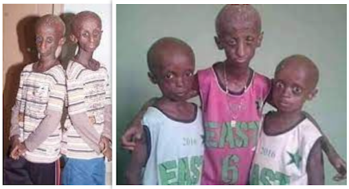 See The Children Of Late Taiwo And Kehinde Osuolale (Ibeji Oran)